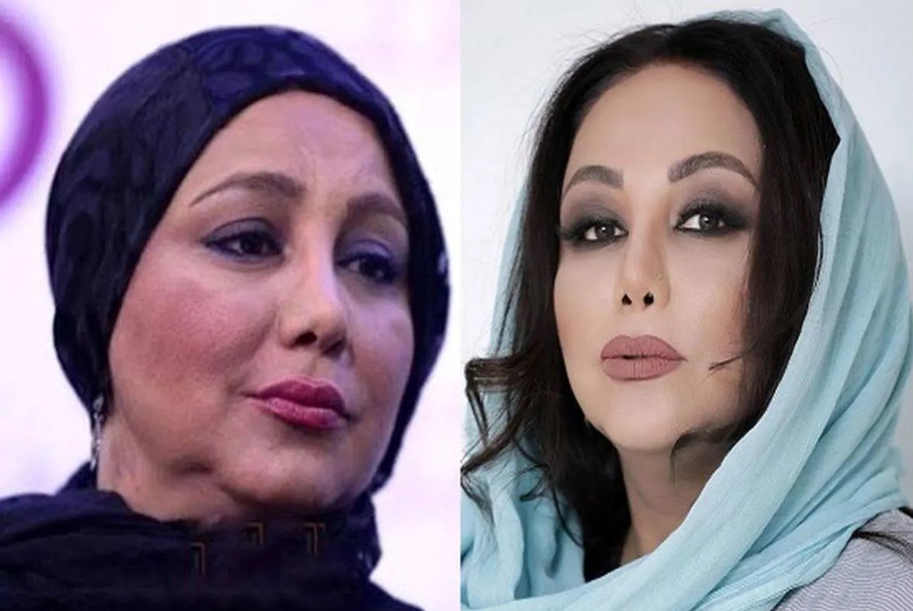 بهنوش بختیاری بعد از عمل
